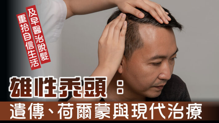 雄性秃