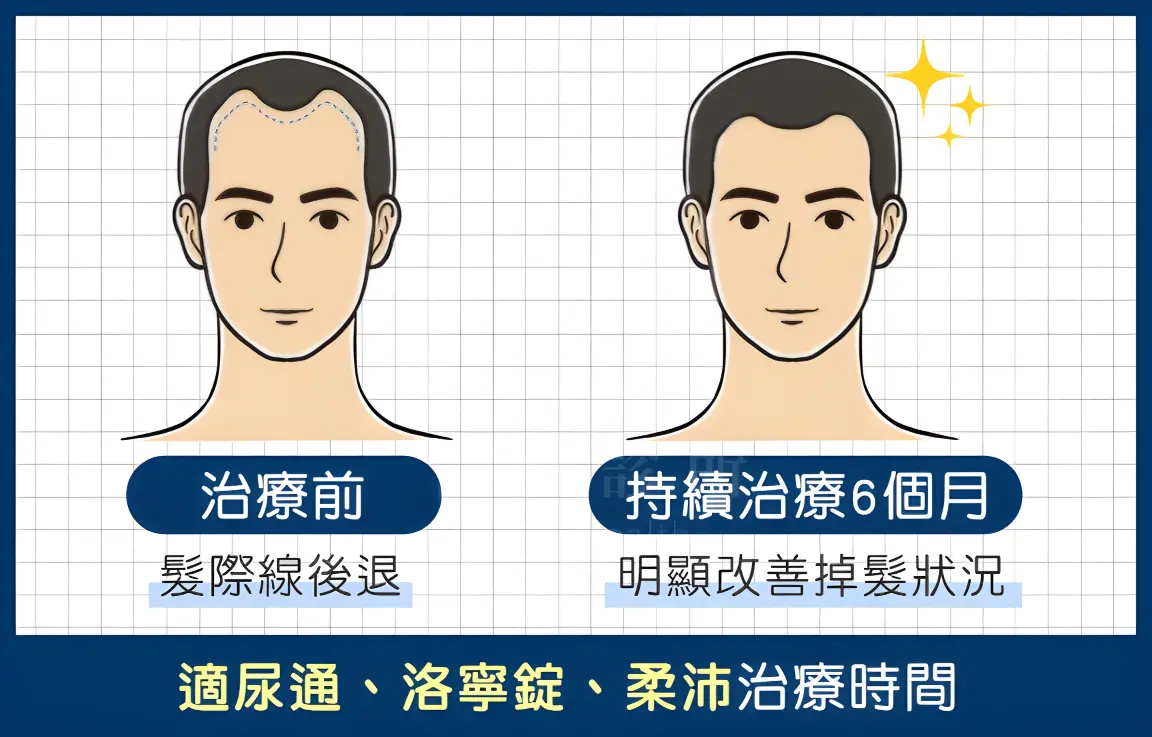 適尿通治療雄性秃真的有效果嗎