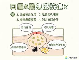 香港口服A酸邊度買